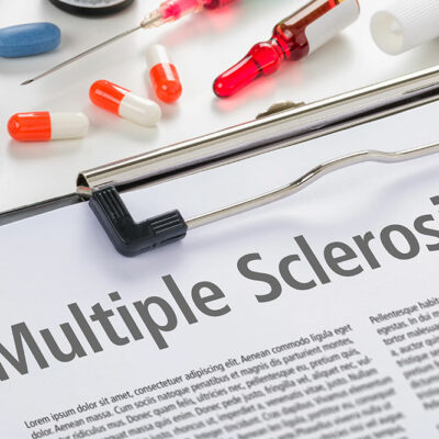 6 Simple Ways to Manage Multiple Sclerosis