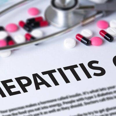 6 Tips to Manage Hepatitis C