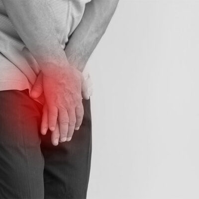 Inherited Genes That Increase the Risk of Prostate Cancer