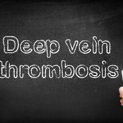 Noticeable Symptoms of Deep Vein Thrombosis (DVT)