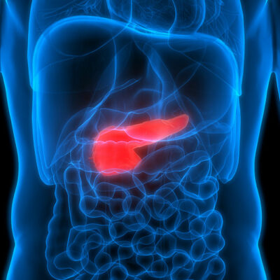 Risk Factors Associated with Pancreatic Cancer