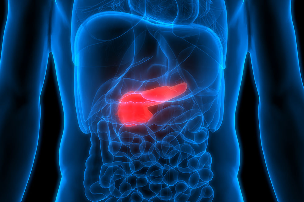 Risk Factors Associated with Pancreatic Cancer